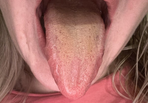 Лечение не помогло ??