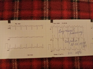 Плохое ЭКГ на фоне волнения