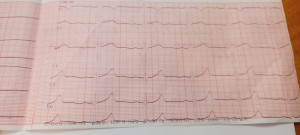 После ЭКГ не дали справку для спорта