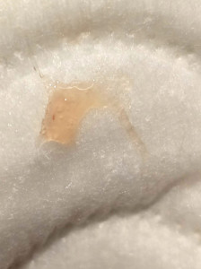 Кровь внутри влагалища