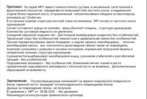 Длительная боль в голеностопном суставе