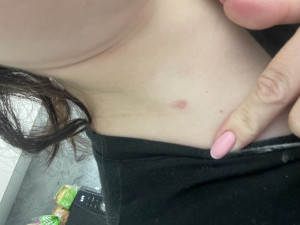 Красное пятно