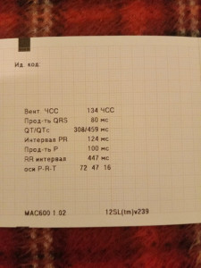 Плохое ЭКГ на фоне волнения