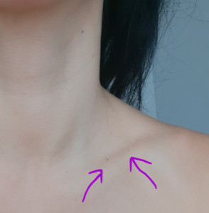 Папиллом становится больше