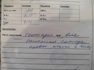 ЭКГ для медкомиссии на проводника (ППВ)