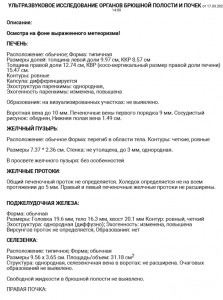 Покалывания в левом и правом подреберье