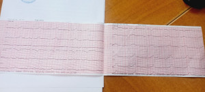 После ЭКГ не дали справку для спорта