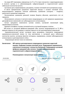 Боль в плече