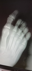 Расшифровать снимки