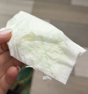 Прозрачные сгустки при беременности