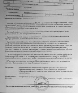 Вывих плечевого сустава