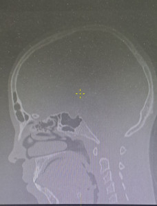 Кт головы с захватом шеи ребенку