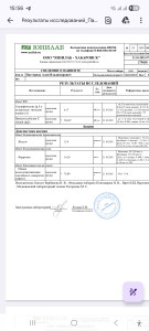Общий иммуноглобулин 536