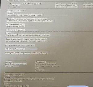 Результат биопсии гастроскопии