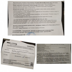 Головокружения