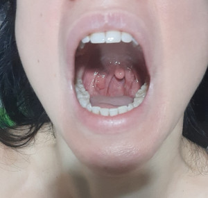 Более 2 недель не могу вылечить горло