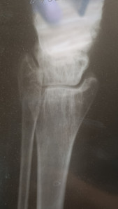 Перелом? (Добавлены фото)