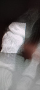 Расшифровать снимки