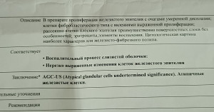 Рак ли по анализу цитологии! Помогите расшифровать
