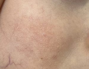 УВАЖАЕМЫЕ ВРАЧИ, помогите пожалуйста!