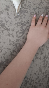 Как уменьшить боль? И что за расстояние между косточками