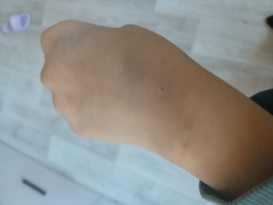 взятие крови с вены