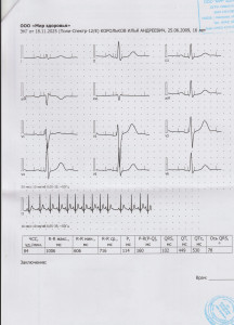 Оцените результат ЭКГ и его заключение