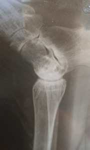 Перелом? (Добавлены фото)