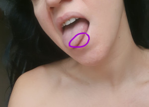 Более 2 недель не могу вылечить горло