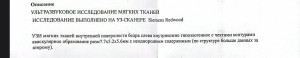 Дерматофиброма в 3 раз