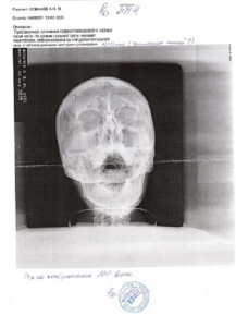 Расшифровка рентгеновского снимка