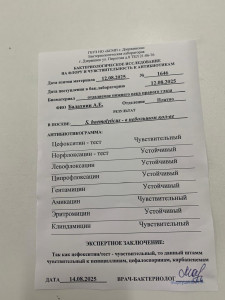 Капли для глаз при конъюнктивите