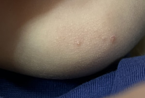 УВАЖАЕМЫЕ ВРАЧИ, помогите пожалуйста!