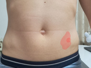 боль в сигмовидной кишке при нажатии