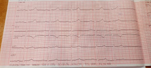 После ЭКГ не дали справку для спорта