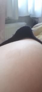 Пигментное пятно не сводится
