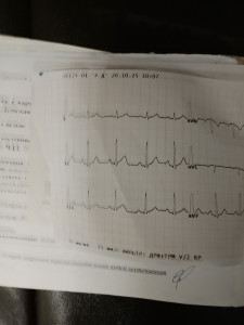 Расшифровка анализа крови и ЭКГ