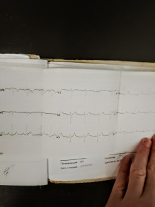 Расшифровка анализа крови и ЭКГ