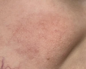 УВАЖАЕМЫЕ ВРАЧИ, помогите пожалуйста!