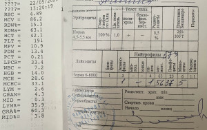 Хрипы, кашля нет,