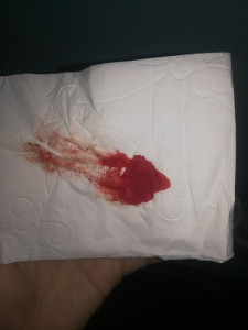 Кровь на туалетной бумаге, или, нет?