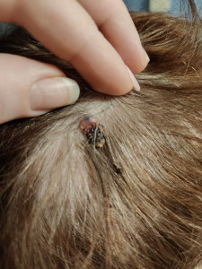 Болячка на голове